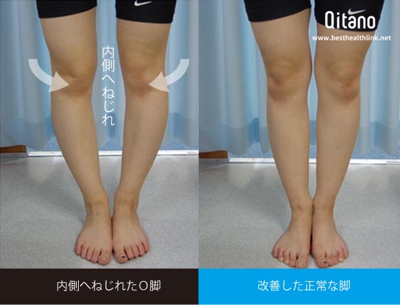 骨盤底筋を締めるとO脚が改善する