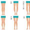 O脚の歪みは５つのタイプがある。あなたのO脚タイプを診断チェック！