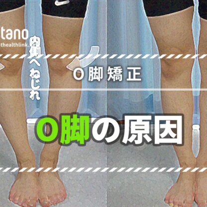 O脚の原因を知れば、改善も見えてくる！日本人に1番多い「内ねじれO脚」矯正法
