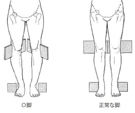 O脚に歪むメカニズム