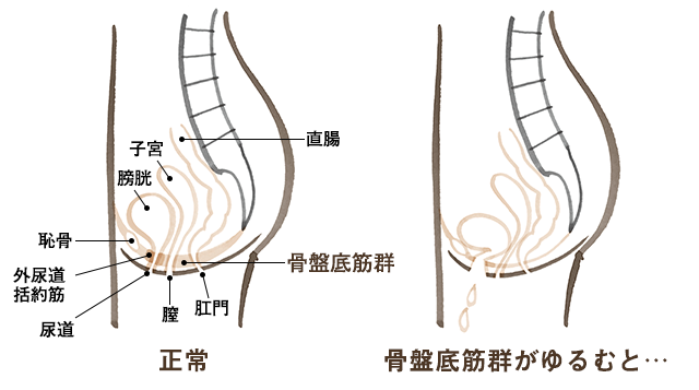 骨盤底筋が緩むと