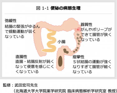 便秘の病態生理