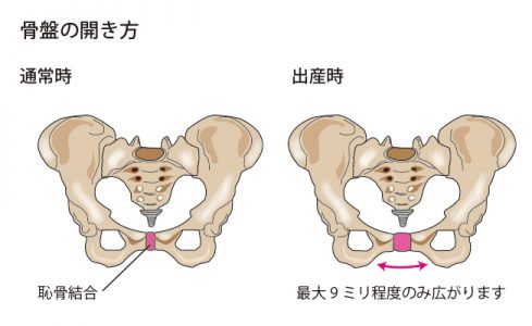 産後の骨盤の開き