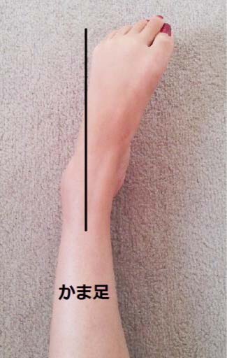 O脚の鎌足