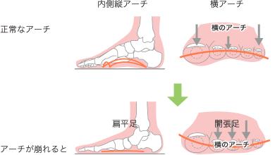 O脚は足のアーチが下がる