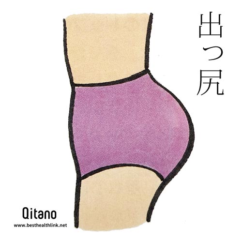 出っ尻タイプ